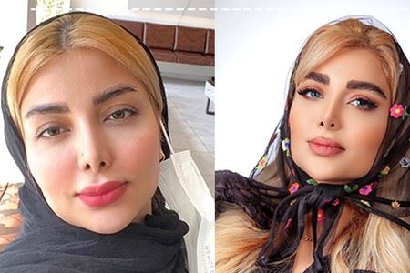 بهترین متخصص کاشت ابرو در پارس آباد