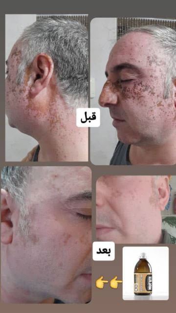 رضایت سلامت جو