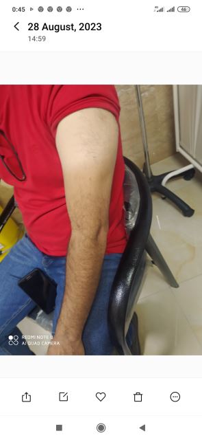 طب سوزنی درمانی