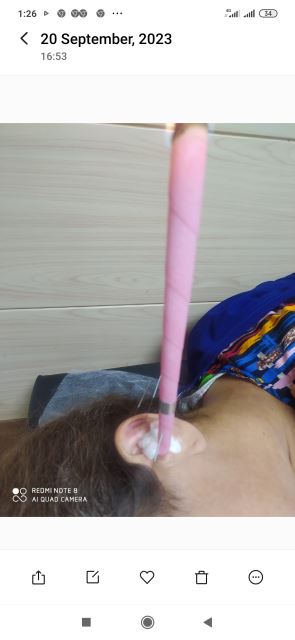 ساکشن گوش به روش شمع تراپی