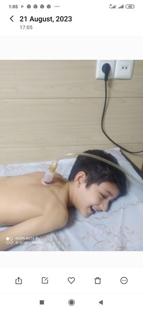 انجام حجامت عام